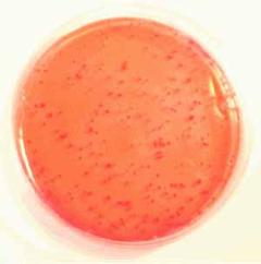 培地上の大腸菌群のコロニーの写真