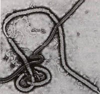 エボラウイルスの画像