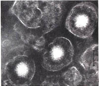 ヘルペスウイルスの画像