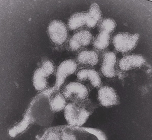 インフルエンザウイルスの画像