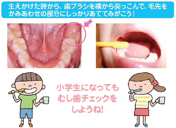 6歳臼歯磨き方