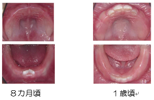 8カ月・1歳頃のお口の写真